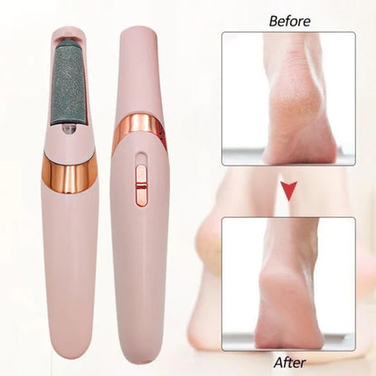 Callus Remover